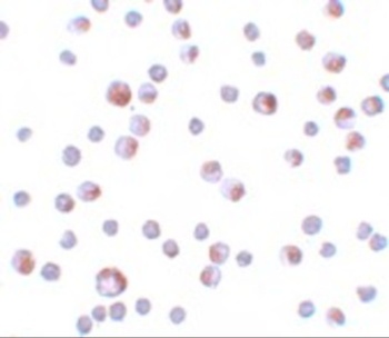 TCTN3 Antibody