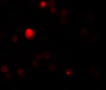 TCTN3 Antibody