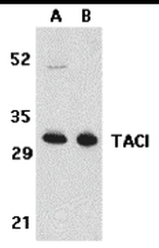 TACI Antibody