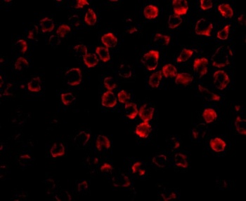 TAB1 Antibody