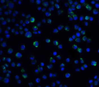 IL-21 Receptor Antibody