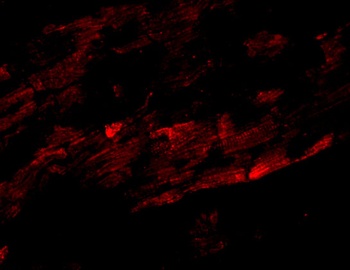 SPG15 Antibody