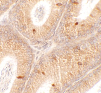 SPATA4 Antibody