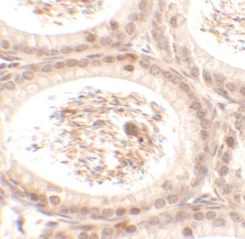 SPATA3 Antibody
