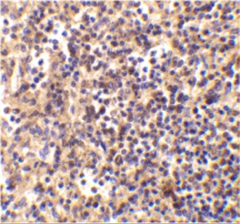 DNase II Antibody