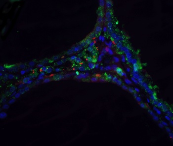 DNase II Antibody