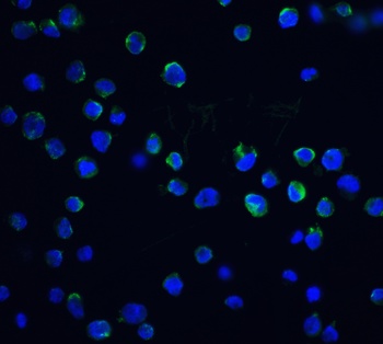 DFF40 Antibody