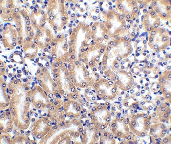 DcR2 Antibody