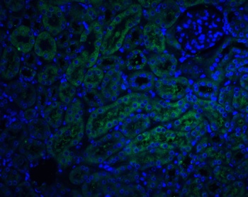DcR2 Antibody