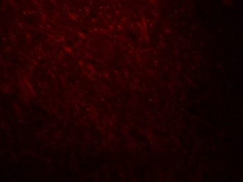 ARID1A Antibody