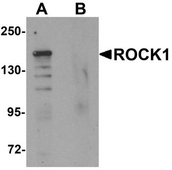 ROCK1 Antibody