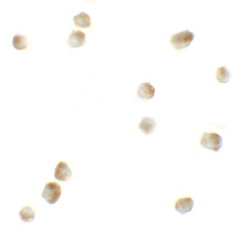 ROCK1 Antibody