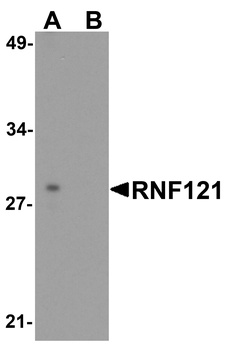 RNF121 Antibody