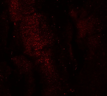 RKHD3 Antibody