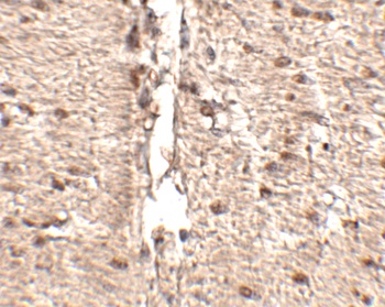 Rkhd1 Antibody