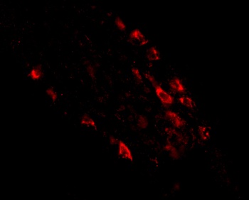 Rkhd1 Antibody