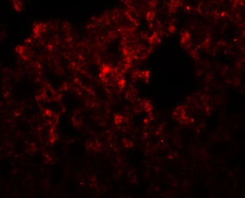 RHBDD3 Antibody