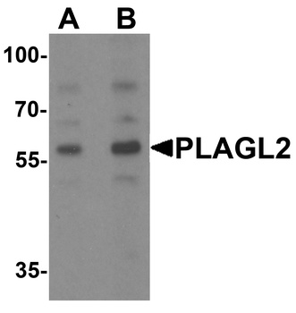 PLAGL2 Antibody
