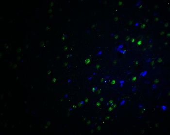 PLAGL2 Antibody