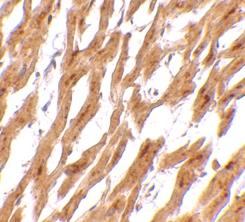 ASAH1 Antibody