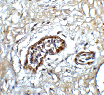 ATF6 Antibody
