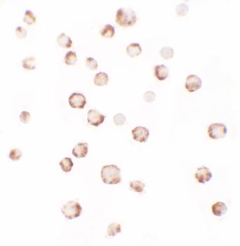 PHLPP2 Antibody
