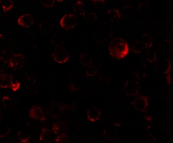 PHLPP2 Antibody