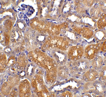 CAD Antibody