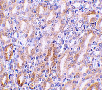 CAD Antibody