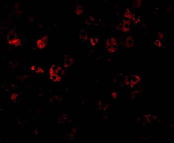 CAD Antibody