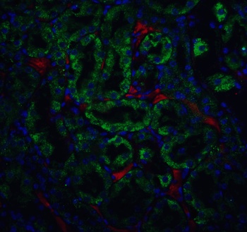 CAD Antibody