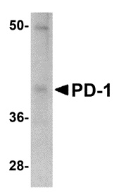 PD-1 Antibody [12A7D7]