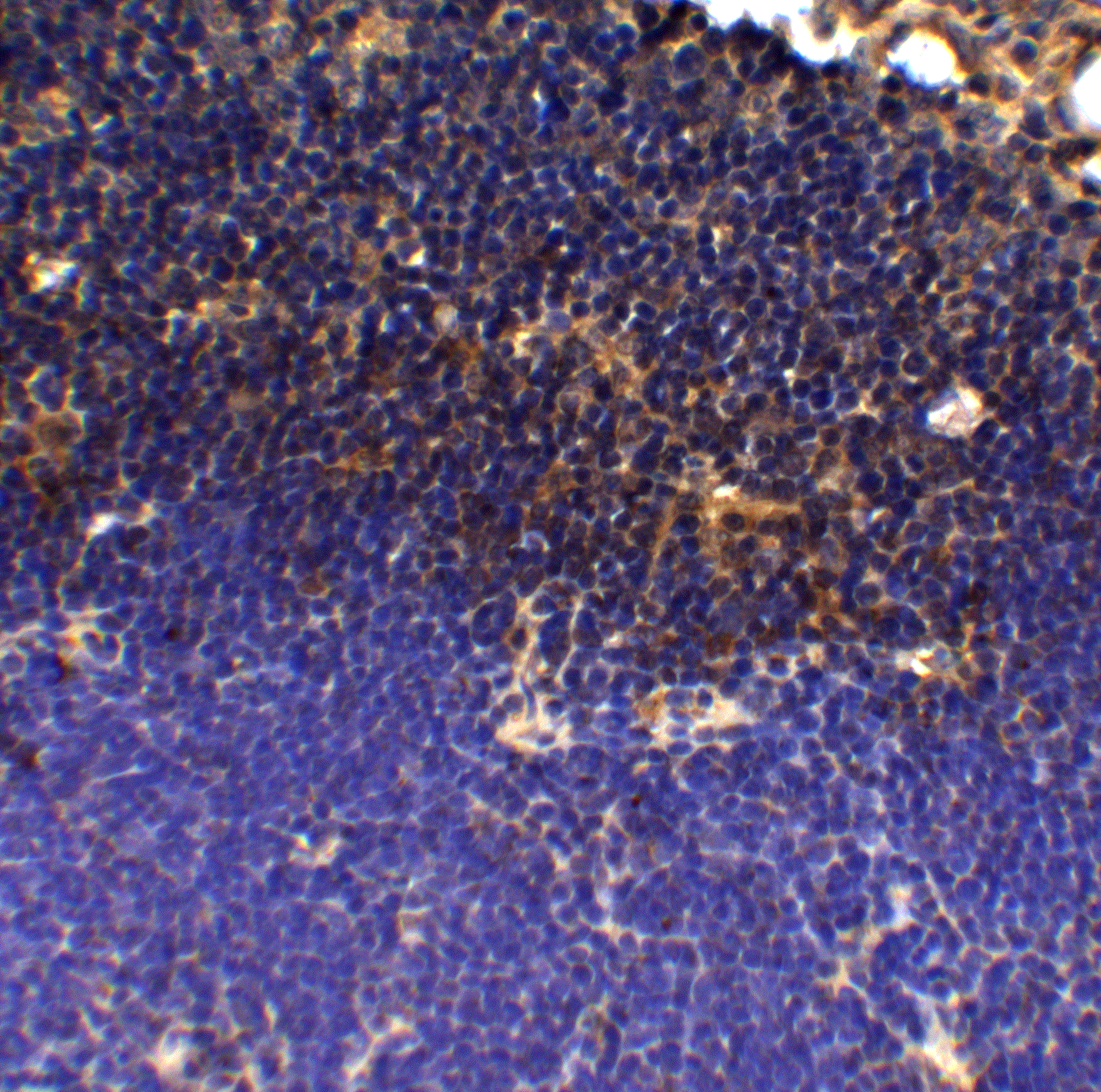 PD-1 Antibody [12A7D7]