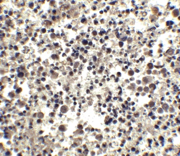 CIDE-A Antibody