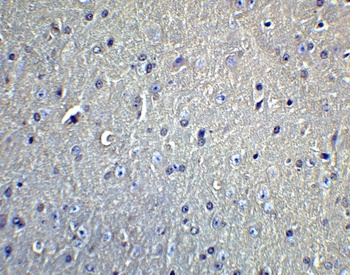 DCLK1 Antibody