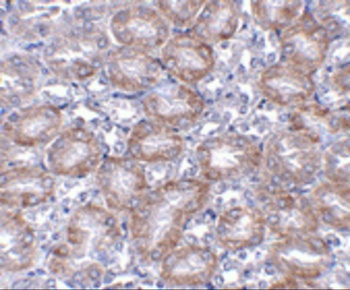 MTCH2 Antibody