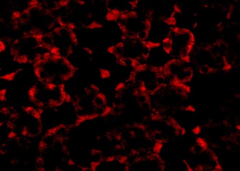 MTCH2 Antibody