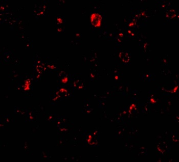 MTBP Antibody