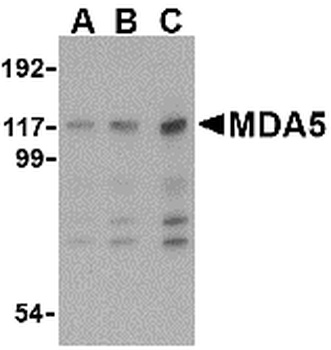 MDA5 Antibody