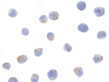 IKK alpha Antibody