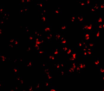 IKK alpha Antibody