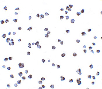 IKK alpha Antibody