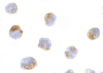 Mcl-1 Antibody