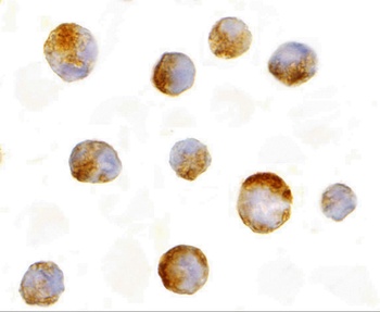 Mcl-1 Antibody