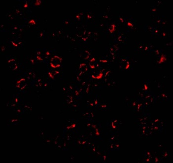 Mcl-1 Antibody
