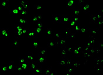 Mcl-1 Antibody