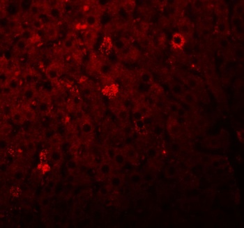 LYRM1 Antibody