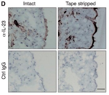 IL-23 Antibody