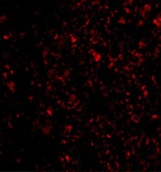 IL-33 Antibody