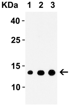 IRAK Antibody